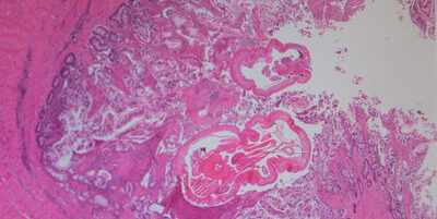 mikroskopische Aufnahme eines unbekannten materials in verschiedenen pink-tönen